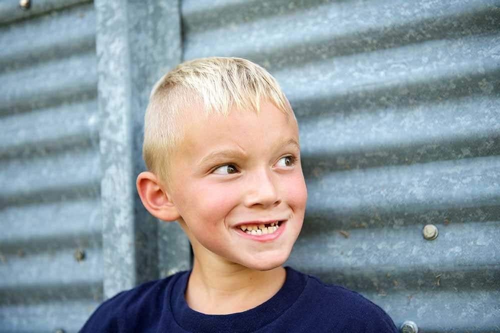 Niño con cicatriz